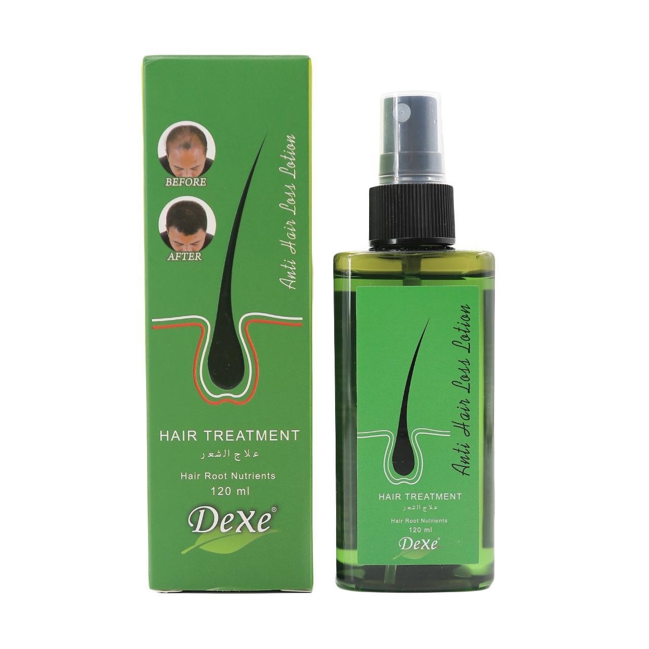 Dexe Anti-hair Loss Lotion Spray 120ml